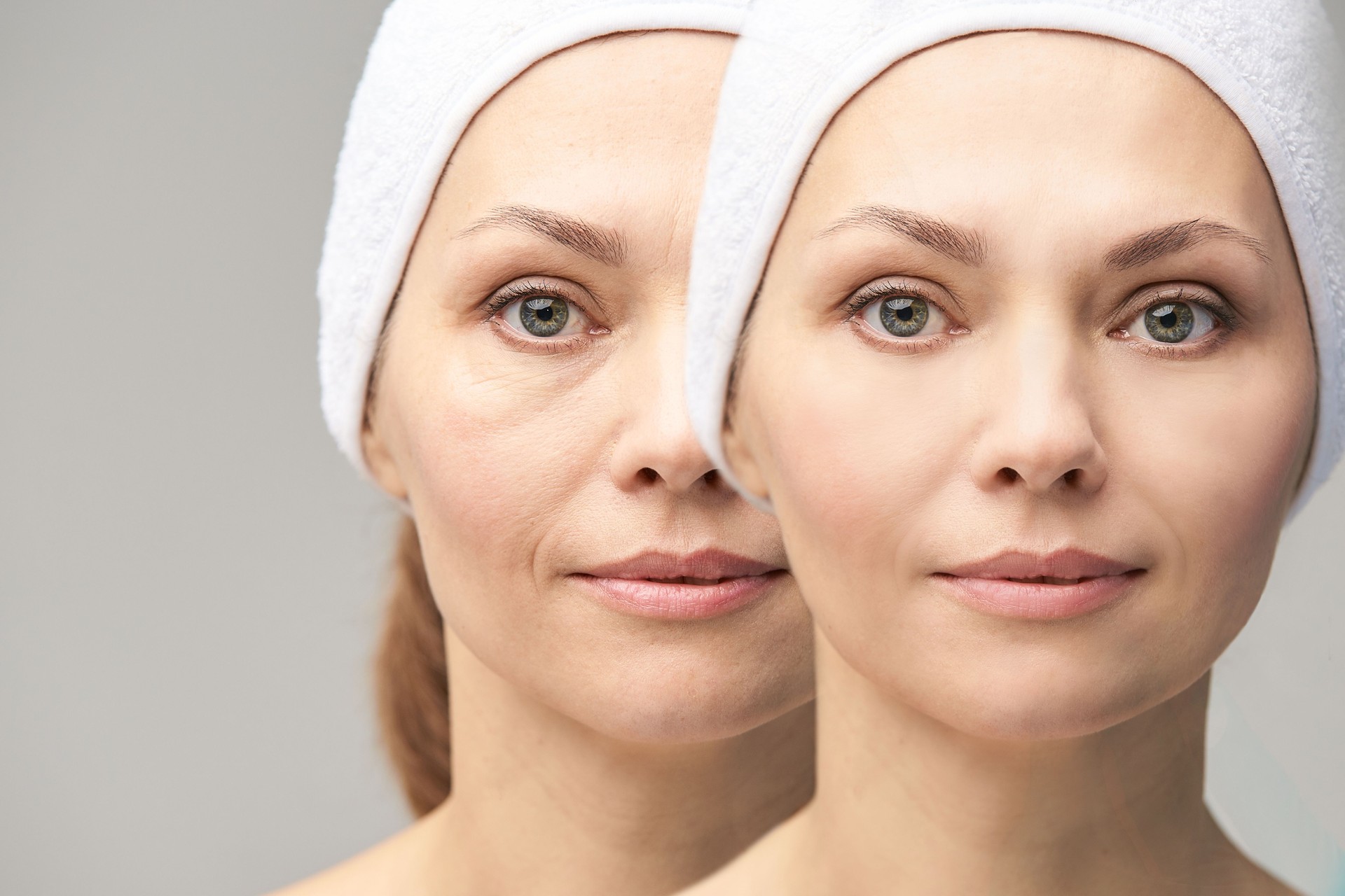 Wrinkle Treatment